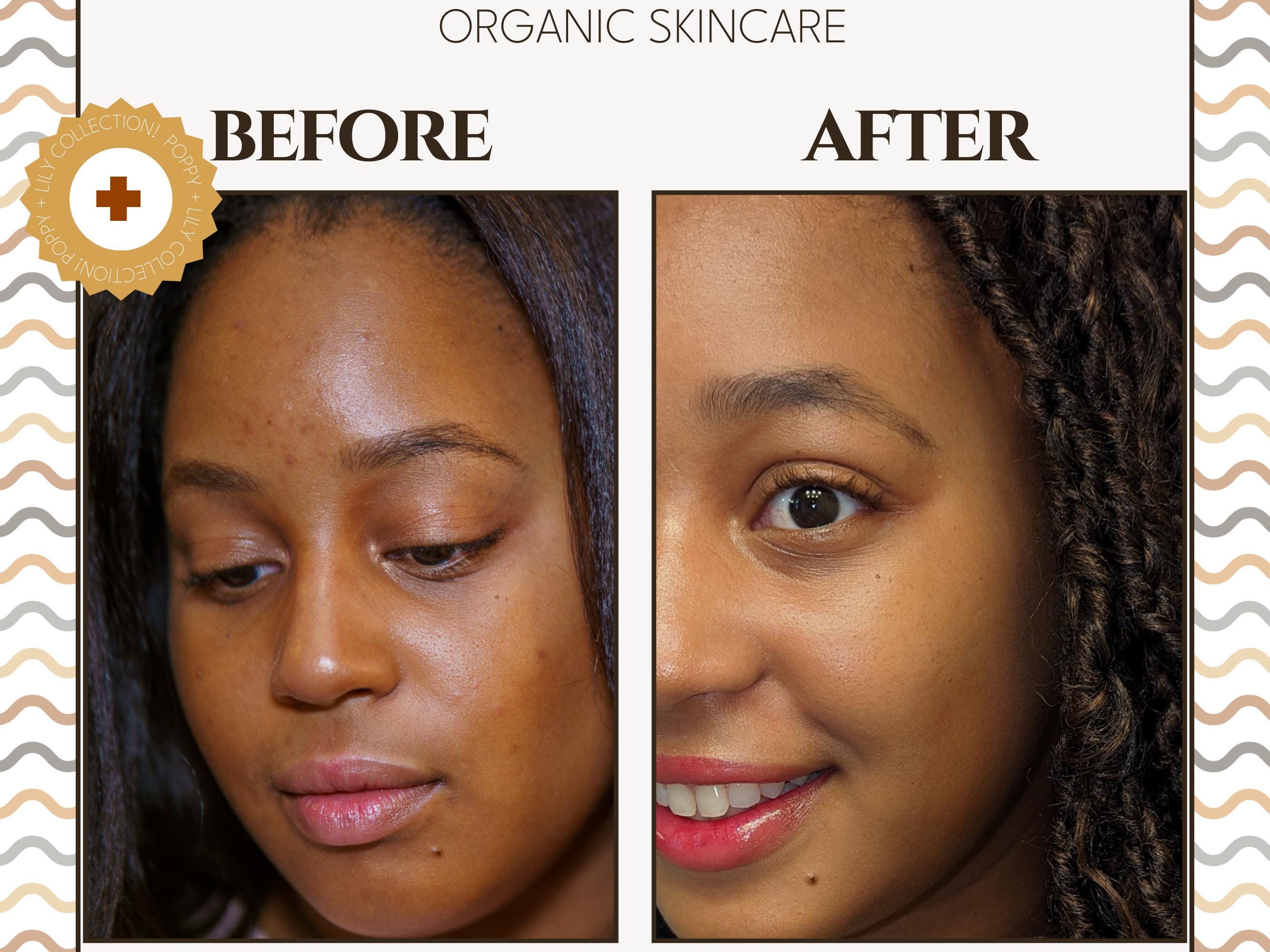 Formula B | Lipid Restoration Concentrate | Brightening Glow Oil