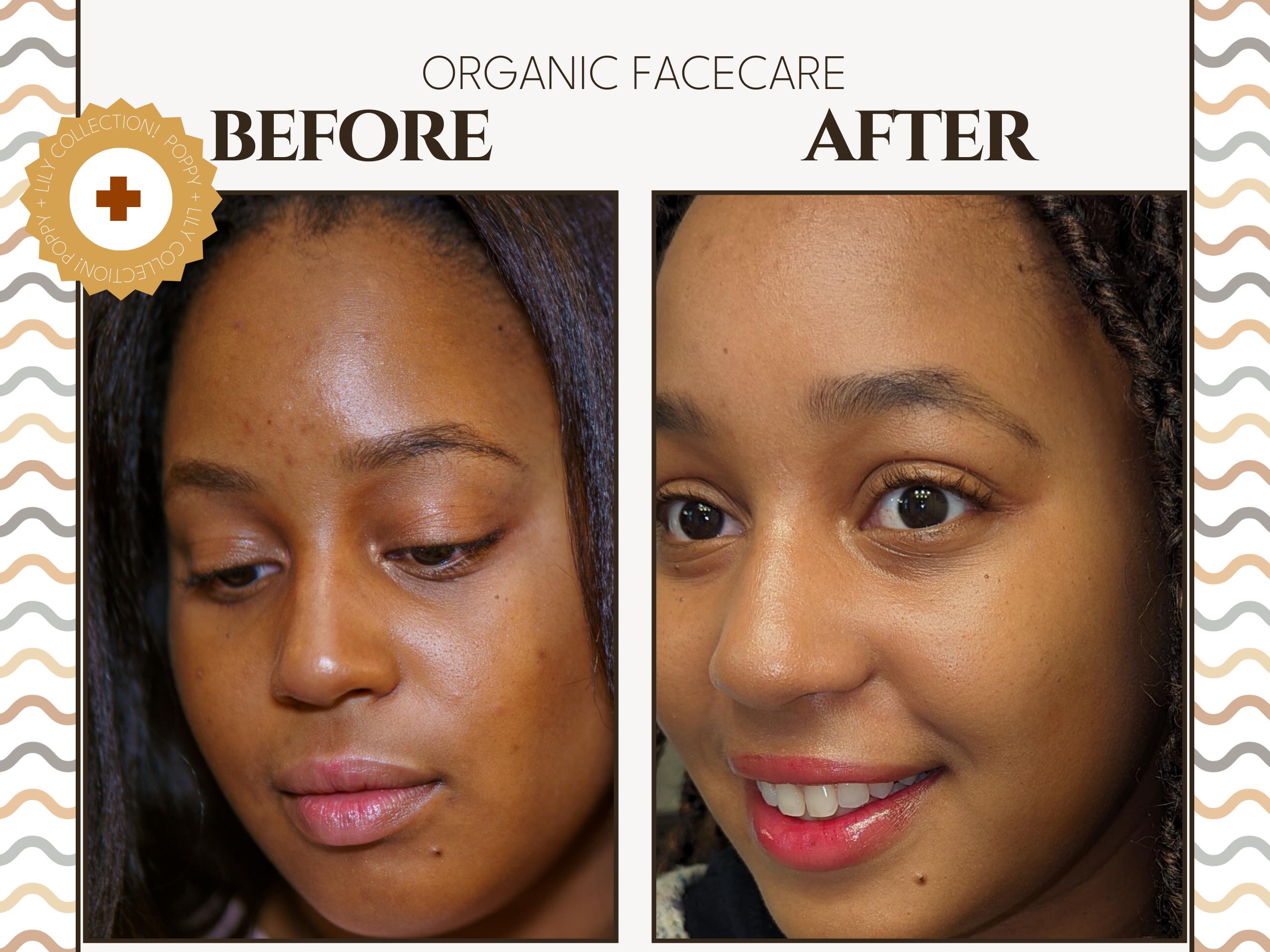 Clean Beauty Skincare Kit | The Organics Series